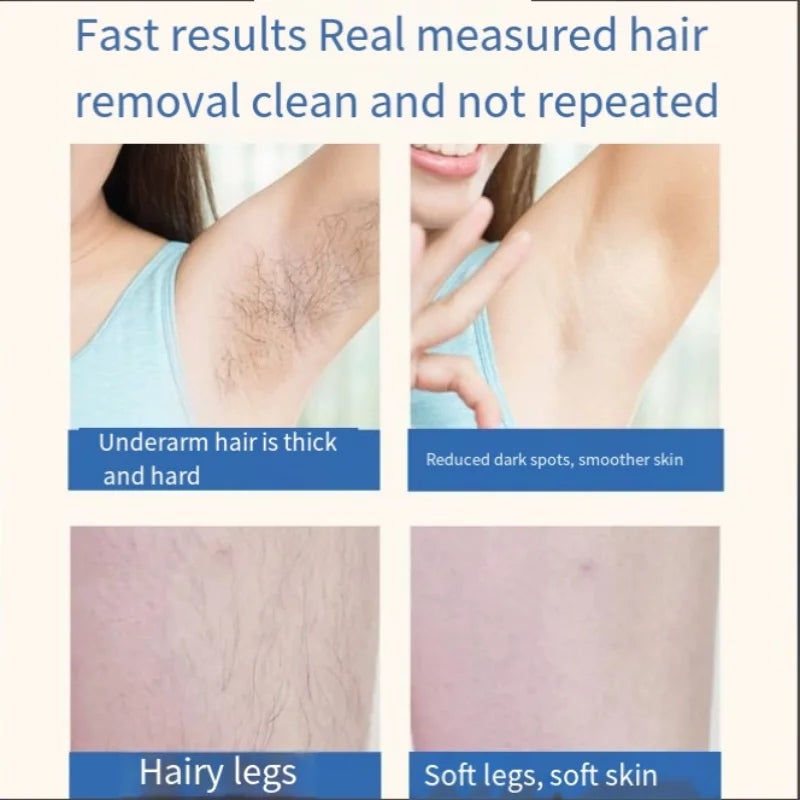 Popular hair removal device laser hair removal device IPL household women's shaving strong pulse hair removal device